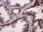 PCNA Antibody in Immunohistochemistry (Paraffin) (IHC (P))