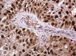 PCNA Antibody in Immunohistochemistry (Paraffin) (IHC (P))