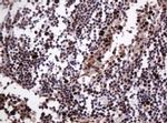 PCNA Antibody in Immunohistochemistry (Paraffin) (IHC (P))