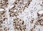 PCNA Antibody in Immunohistochemistry (Paraffin) (IHC (P))