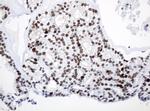 PCNA Antibody in Immunohistochemistry (Paraffin) (IHC (P))