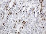 PCNA Antibody in Immunohistochemistry (Paraffin) (IHC (P))