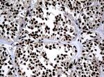 PCNA Antibody in Immunohistochemistry (Paraffin) (IHC (P))