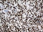 PCNA Antibody in Immunohistochemistry (Paraffin) (IHC (P))