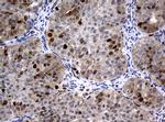 PCNA Antibody in Immunohistochemistry (Paraffin) (IHC (P))