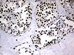 PCNA Antibody in Immunohistochemistry (Paraffin) (IHC (P))