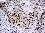 PCNA Antibody in Immunohistochemistry (Paraffin) (IHC (P))