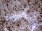 PCNA Antibody in Immunohistochemistry (Paraffin) (IHC (P))