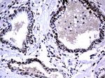 PCNA Antibody in Immunohistochemistry (Paraffin) (IHC (P))