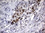 PCNA Antibody in Immunohistochemistry (Paraffin) (IHC (P))