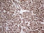 PCNA Antibody in Immunohistochemistry (Paraffin) (IHC (P))