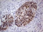 PCNA Antibody in Immunohistochemistry (Paraffin) (IHC (P))