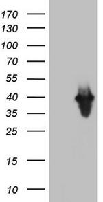 PCNA Antibody in Western Blot (WB)