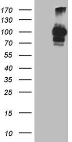 PCSK9 Antibody in Western Blot (WB)