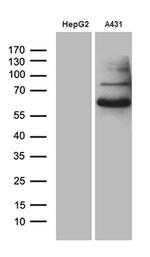 PCSK9 Antibody in Western Blot (WB)