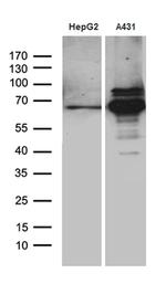 PCSK9 Antibody in Western Blot (WB)