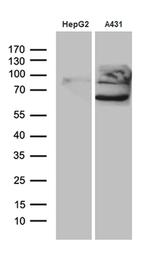 PCSK9 Antibody in Western Blot (WB)