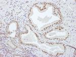 PCYT1A Antibody in Immunohistochemistry (IHC)