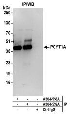 PCYT1A Antibody in Western Blot (WB)