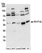 PCYT1A Antibody in Western Blot (WB)