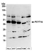 PCYT1A Antibody in Western Blot (WB)