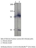 PDE11A Antibody in Western Blot (WB)