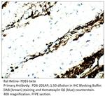 PDE6 Beta Antibody in Immunohistochemistry (IHC)