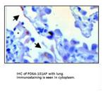 PDE6 Alpha Antibody in Immunohistochemistry (IHC)