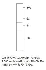 PDE9A Antibody in Western Blot (WB)