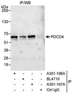 PDCD4 Antibody in Immunoprecipitation (IP)