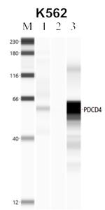 PDCD4 Antibody in Immunoprecipitation (IP)