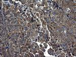 PDCD6IP Antibody in Immunohistochemistry (Paraffin) (IHC (P))