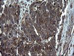 PDCD6IP Antibody in Immunohistochemistry (Paraffin) (IHC (P))