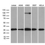 PDCL3 Antibody in Western Blot (WB)