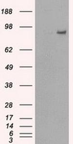 PDE10A Antibody in Western Blot (WB)