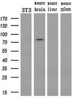 PDE10A Antibody in Western Blot (WB)