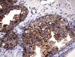 PDE1A Antibody in Immunohistochemistry (Paraffin) (IHC (P))