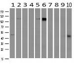 PDE2A Antibody in Western Blot (WB)