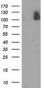 PDE2A Antibody in Western Blot (WB)