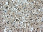 PDE4A Antibody in Immunohistochemistry (Paraffin) (IHC (P))