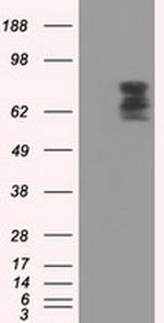 PDE4A Antibody in Western Blot (WB)