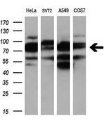 PDE4A Antibody in Western Blot (WB)