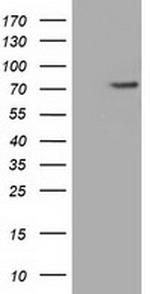 PDE4A Antibody in Western Blot (WB)