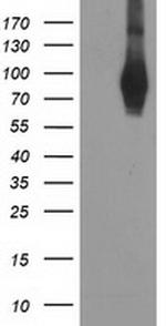 PDE4B Antibody in Western Blot (WB)