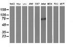 PDE4B Antibody in Western Blot (WB)