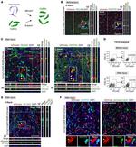 CD140a (PDGFRA) Antibody in Immunohistochemistry (IHC)