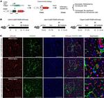 CD140a (PDGFRA) Antibody in Immunohistochemistry (IHC)