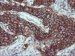 PDGFRB Antibody in Immunohistochemistry (Paraffin) (IHC (P))