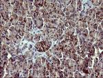 PDGFRB Antibody in Immunohistochemistry (Paraffin) (IHC (P))