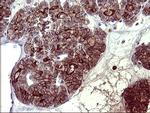 PDGFRB Antibody in Immunohistochemistry (Paraffin) (IHC (P))